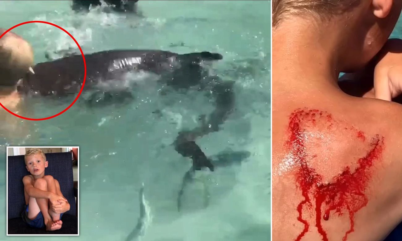 وقوع اتفاق وحشتناک برای پسر 8 ساله در ساحل!