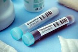  بالاخره تکلیف‌مان با کرونا چیست؟