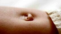 فتق ناف چه زمانی برطرف می شود؟