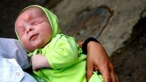 تولد نوزاد بدون چشم در روسیه!