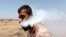 شلیک مستقیم گلوله گاز اشک آور به صورت جوان فلسطینی