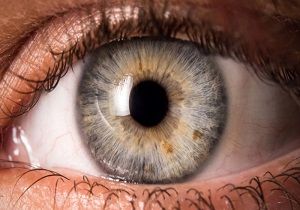 لکه‌های روی عنبیه چشم ، چه چیزی درمورد سلامتتان می گوید؟