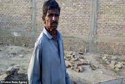بیماری وحشتناک مرد جوان پاکستانی سوژه رسانه ها شد!