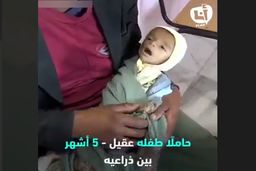 لحظاتی دردناک از تلاش پدر یمنی برای نجات جان کودک شیرخواره‌اش
