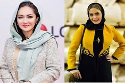 صورت زخمی نیکی کریمی و چهره متفاوت الناز شاکردوست