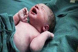 تولد جنین فریز شده پس از ۱۳ سال در اصفهان