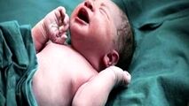 تولد جنین فریز شده پس از ۱۳ سال در اصفهان