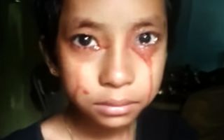 عرق و اشک‌های خونین دختر بچه هندی شوکه کننده است 
