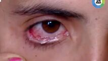 اشک‌های بلورینی که از چشمان دختر ۲۲ ساله سرازیر می‌شود