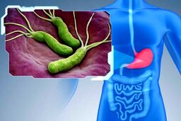 
میکروب هلیکوباکتر چگونه وارد بدن می‌شود؟