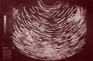 راهپیمایی آلمانی‌ها در اعتراض به عمل سقط جنین!